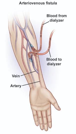 kidney doctor in kolkata